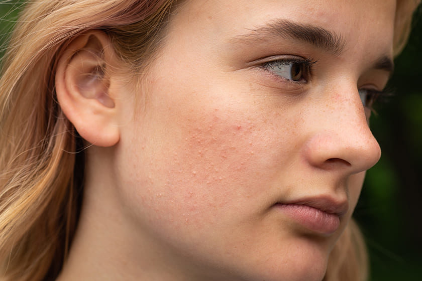 3 Women With Radiant Skin