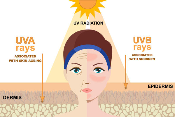 Sun damaged Skin: Signs, Causes & Treatment